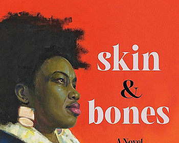 Skin & Bones by Renee Watson book cover