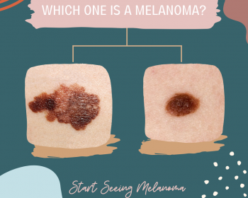 Start Seeing Melanoma campaign graphic